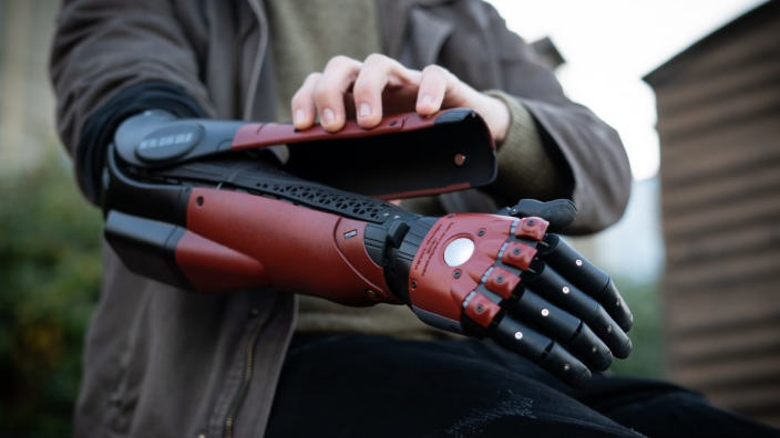 Protesi bionica di Metal Gear Solid per un ragazzo inglese